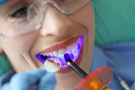 Young woman treating teeth with cordless LED curing light machine closeupの写真素材