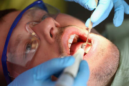 A man treats teeth, a patients calm face close-upの写真素材