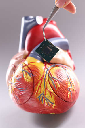 Model of heart with cardiac pacemaker in form of chipの写真素材