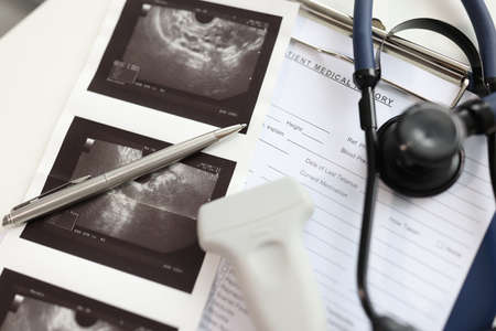Ultrasound sensor with pictures and stethoscope lying on patient medical history closeupの写真素材