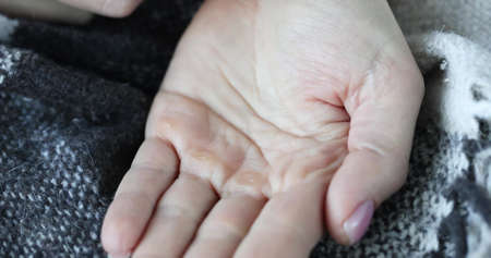 Person pours medical pills into hand