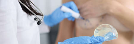 Plastic surgeon holding silicone breast implant and applying preoperative markings to patient chest closeupの写真素材