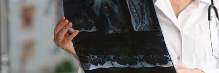 Young woman doctor is holding x-ray of person spineの写真素材