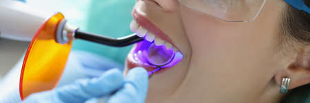 Female client on appointment in stomatology cabinet getting whitening procedureの写真素材