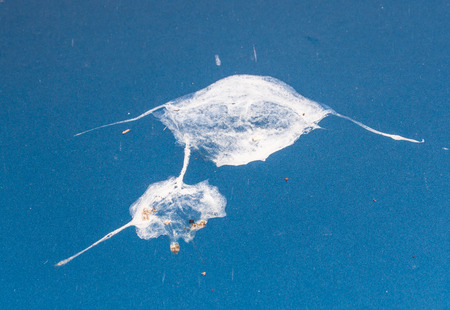 Bird droppings on my ocean blue car!の写真素材