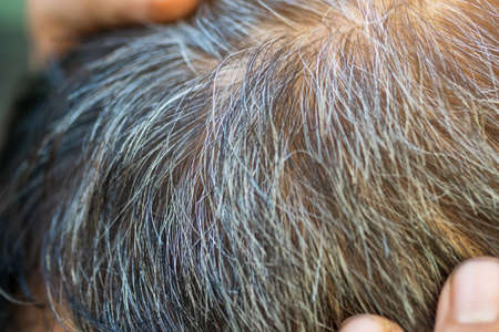 Gray hair problems in older men, old asian senior man with gray hair, white hair or hair loss problemの写真素材