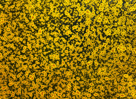 All-over photograph of a highly detailed texture depicting a surface covered by a multitude of golden patterns of oblong shapes, ellipses and random circles looking like bacterial biological cells.の写真素材