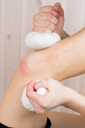 massage with herbal bags patient's knee for preventionの写真素材
