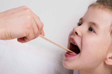 a doctor's examination of the throat of a little girl, a little girl opened her mouth wideの写真素材