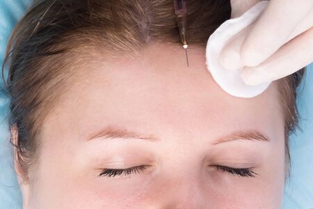 close-up of a girl doing a medical procedure for rejuvenating her faceの写真素材