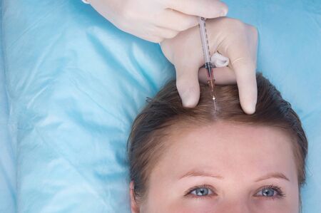 cosmetology, injection into the scalp of a woman, for hair growth, there is a place for the...