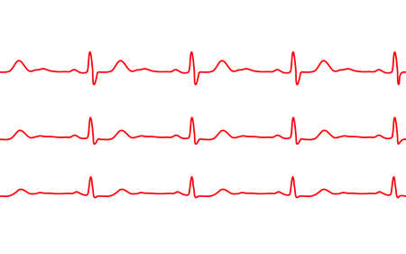 Heart beat ecg or ekg seamless red line on white