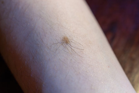 A small tick crawling on human skin a dangerous insect threatening health and well being outdoors...