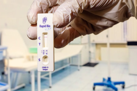 A hand holding a covid-19 rapid antigen self test kit showing positive result in laboratory...