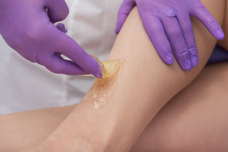Sugaring epilation skin care with liquid sugar at legs.の写真素材