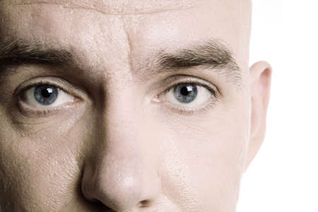 depression in eyesの写真素材