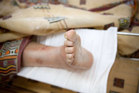 senior in hospital