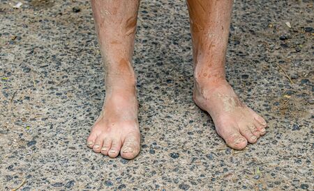 Human feet in the mud in natureの写真素材