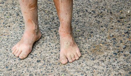 Human feet in the mud in natureの写真素材