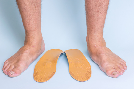 Male legs with signs of flat feet and joints and orthopedic insoles on a blue background. Photos of...