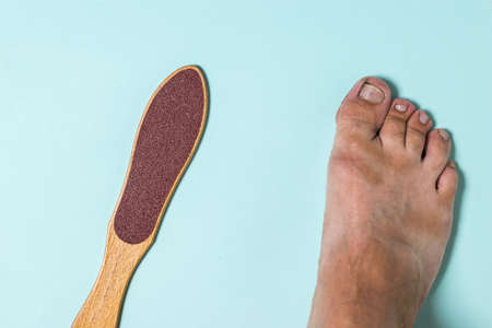 The man's right leg and a device for cleaning rough skin. Treatment of leg skin.