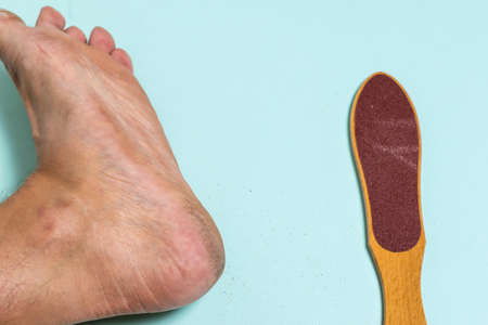 A man's leg with rough skin and a cleaning device. Treatment of leg skin.