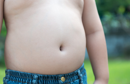 The size of stomach of children with overweight.の写真素材