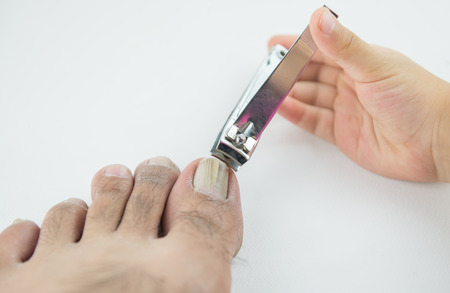 nail clipper cutting man toenails by little handの写真素材