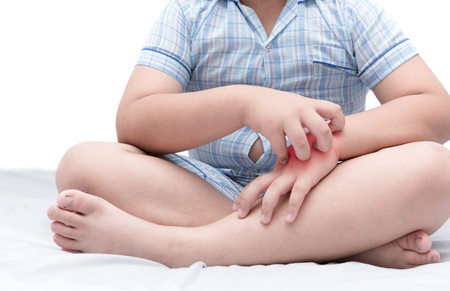 obese fat boy scratch the itch with hand because of mosquito bites isolated on white background, Concept with healthcare and medicineの写真素材