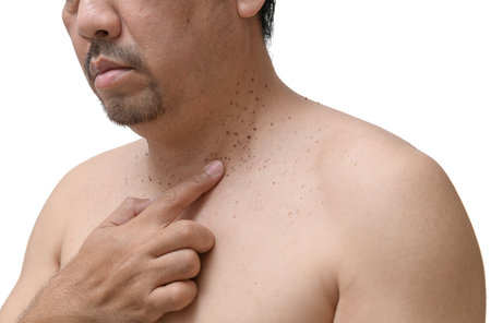 middle age senior man point to skin tags or acrochordon on his neck isolated on white background. Health care conceptの写真素材
