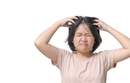 Asian girl scratching the scalp isolated on white background, Hair care conceptの写真素材