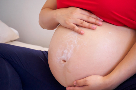 Pregnant Woman applying stretch marks cream on her bellyの写真素材