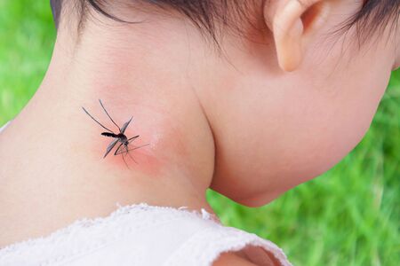 cute asian baby girl has rash and allergy on neck skin from mosquito bite and sucking blood while playing outdoorの写真素材