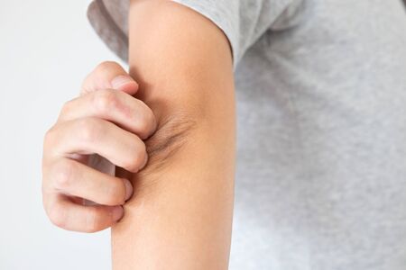 Young asian man itching and scratching on arm from itchy dry skin eczema dermatitis