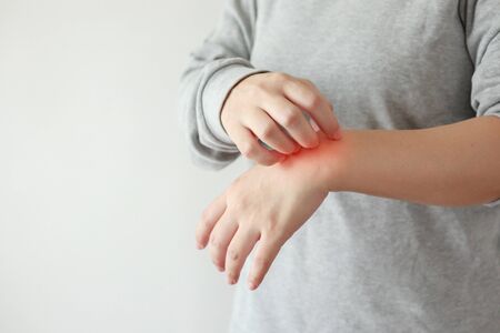 Young asian woman itching and scratching on arm from itchy dry skin eczema dermatitisの写真素材