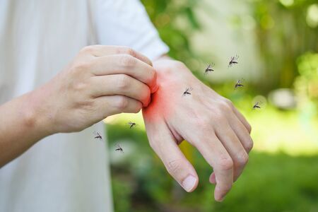 Man itching and scratching on hand from allergy skin rash cause by Mosquitoes biteの写真素材