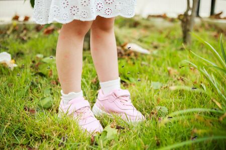 cute asian little girl has skin rash and allergy from mosquito bite and sucking blood at legs while playing on green grass field outdoorの写真素材