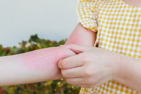 Little girl has skin rash allergy and itchy on her arm