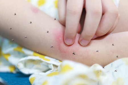 Little girl has skin rash allergy and itchy on her arm from mosquito biteの写真素材