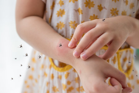 Little girl has skin rash allergy and itchy on her arm from mosquito biteの写真素材