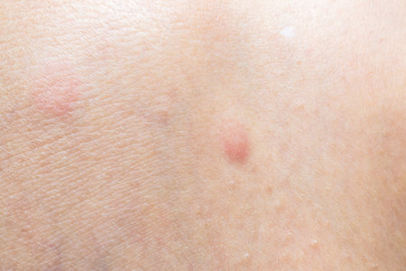 Skin allergy rash dermatitis texture close upの写真素材