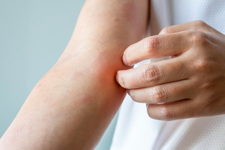 Young asian man itching and scratching on arm from allergic itchy dry skin eczema dermatitis insect bitesの写真素材