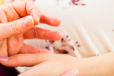 Midwife setting pregnant woman acupuncture needleの写真素材