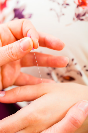 Midwife setting pregnant woman acupuncture needleの写真素材