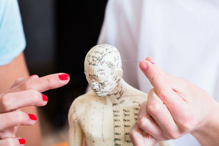 Alternative practitioner explaining acupuncture pinching needles in model with meridians painted onの写真素材