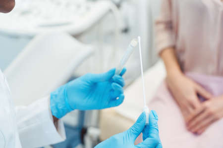 Gynecologist testing vaginal swab for STD, close-upの写真素材