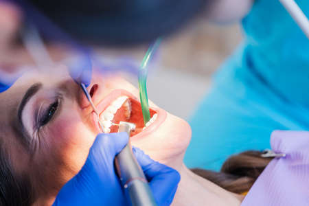 Beautiful woman at the dentist in prophylaxis sessionの写真素材