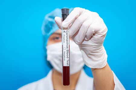 Young female doctor wearing respirator mask holding a positive blood test result for the new rapidly spreading worldwide Coronavirus. Nurse with a Covid-19 test tube.の写真素材