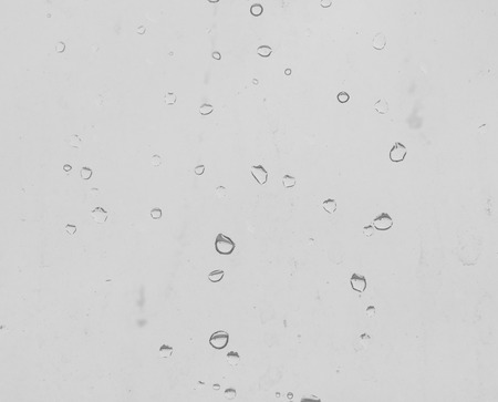 raindrops closeupの写真素材