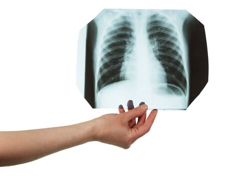Radiograph of a lung in a female hand, isolated on whiteの写真素材
